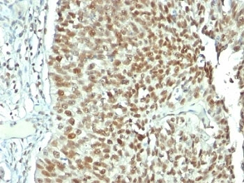 Nucleolin Antibody