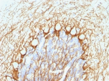 NF-H Antibody (phospho)