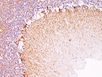 Neurofilament Antibody