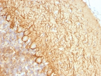 Neurofilament Antibody