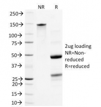 Neurofilament Antibody