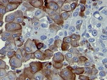 p75NTR Antibody