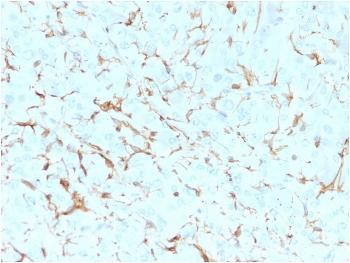 NGF Receptor Antibody / p75NTR / CD271