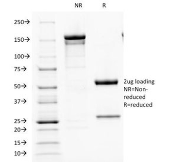 Parathyroid Hormone Antibody / C-Terminal
