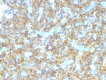 PTH Antibody / C-Terminal