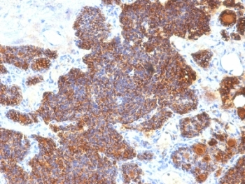 PTH Antibody / C-Terminal