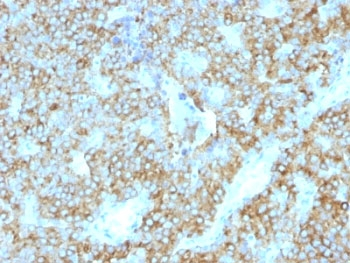 PTH Antibody / C-Terminal