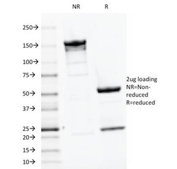 PTH Antibody / C-Terminal
