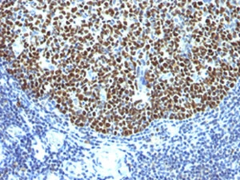 Bcl6 Antibody
