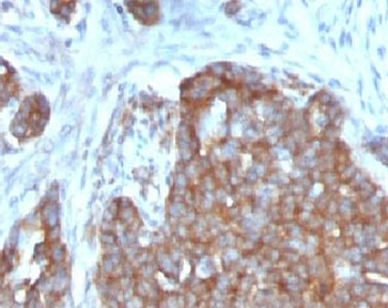 Estrogen Inducible Protein pS2 / TFF1 Antibody