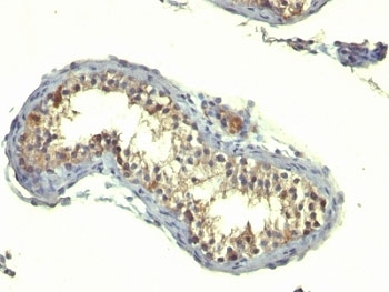 TGFa Antibody