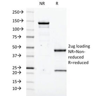 Transglutaminase 2 Antibody