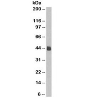 Cytokeratin 5/8 Antibody