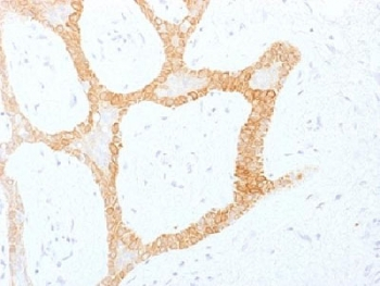 Cytokeratin 5/8 Antibody