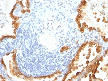 Cytokeratin 8/18 Antibody Cocktail