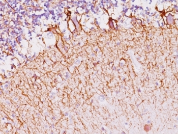 Neurofilament Antibody (Heavy + Light)