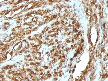 Pan Muscle Actin Antibody Cocktail