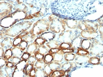 Mitochondrial Antibody
