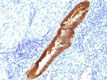 ASRGL1 Antibody