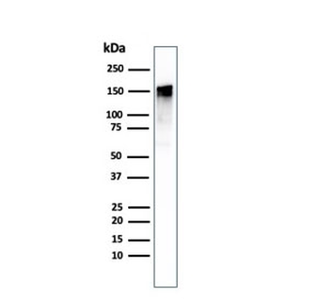 EGF Receptor / EGFR Antibody