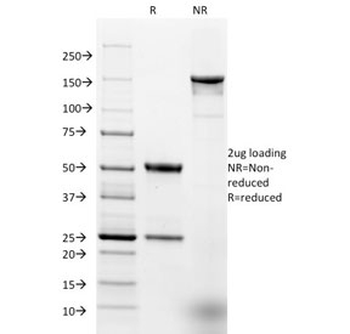 EpCAM Antibody / Extracellular domain