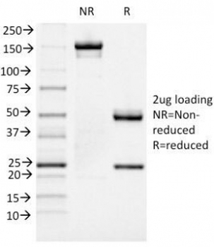 FOXA1 Antibody