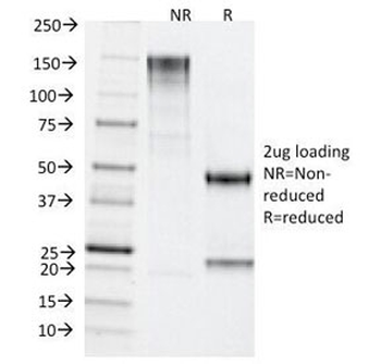 TDP2 Antibody / Tyrosyl-DNA phosphodiesterase 2 / ETS1 associated protein II
