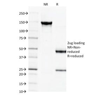 Spectrin beta III Antibody / SPTBN2