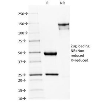 Spectrin beta III Antibody / SPTBN2