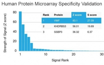 von Willebrand Factor Antibody / vWF