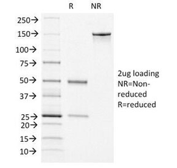 von Willebrand Factor Antibody / vWF