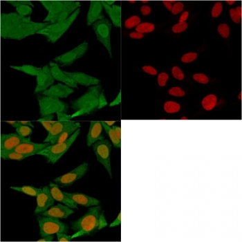 S100A4 Antibody / FSP1