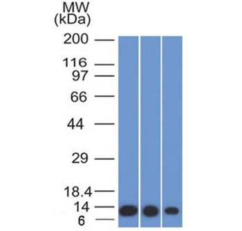 S100A4 Antibody / FSP1