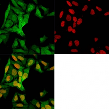 S100A4 Antibody / FSP1