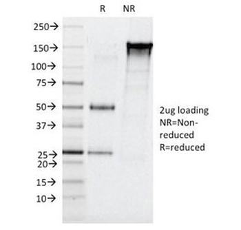 Elastase 3B Antibody / CELA3B