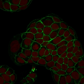 Ep-CAM Antibody