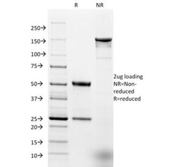 Ep-CAM Antibody
