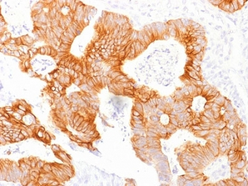 Ep-CAM Antibody