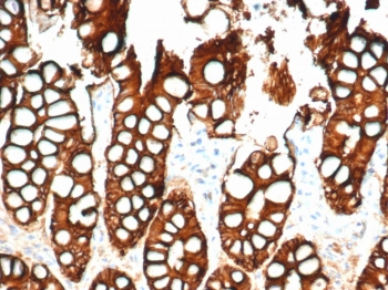 Ep-CAM Antibody