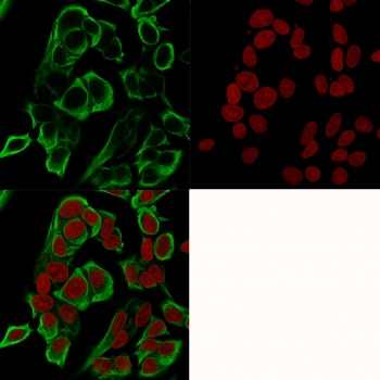 Recombinant EpCAM Antibody