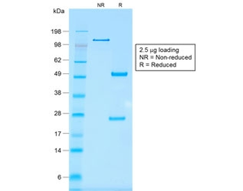 Recombinant EpCAM Antibody