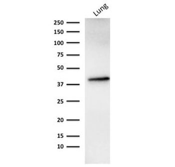 Recombinant EpCAM Antibody
