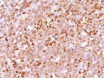 CD79a Antibody