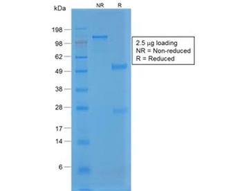 Recombinant vWF Antibody