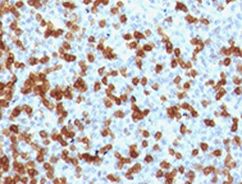 Recombinant PD-1 Antibody / Rabbit Monoclonal