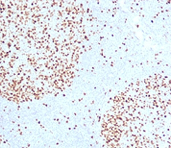 TOP2A Antibody / Topoisomerase II alpha