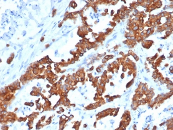 Recombinant EpCAM Antibody / Rabbit Monoclonal