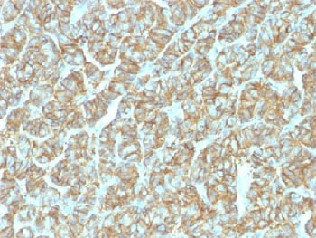 Recombinant EpCAM Antibody / Rabbit Monoclonal