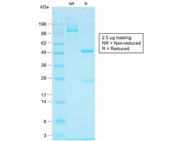 Recombinant EpCAM Antibody / Rabbit Monoclonal