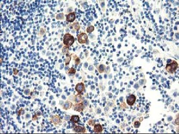 DPP10 Antibody